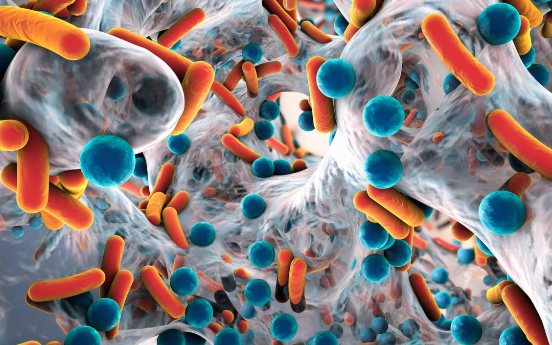 Biofilm and Inflammation in Wound Healing