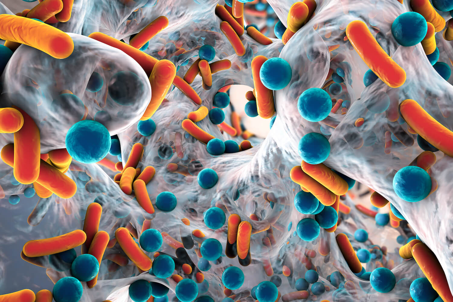 Biofilm and Inflammation in Wound Healing
