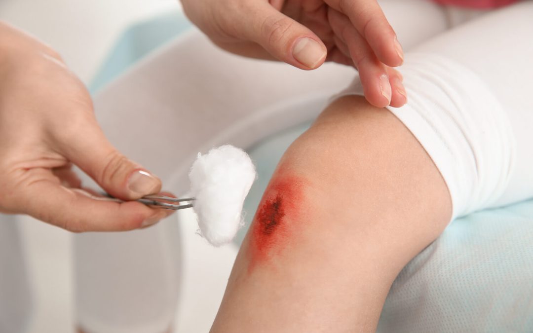 Periwound Management