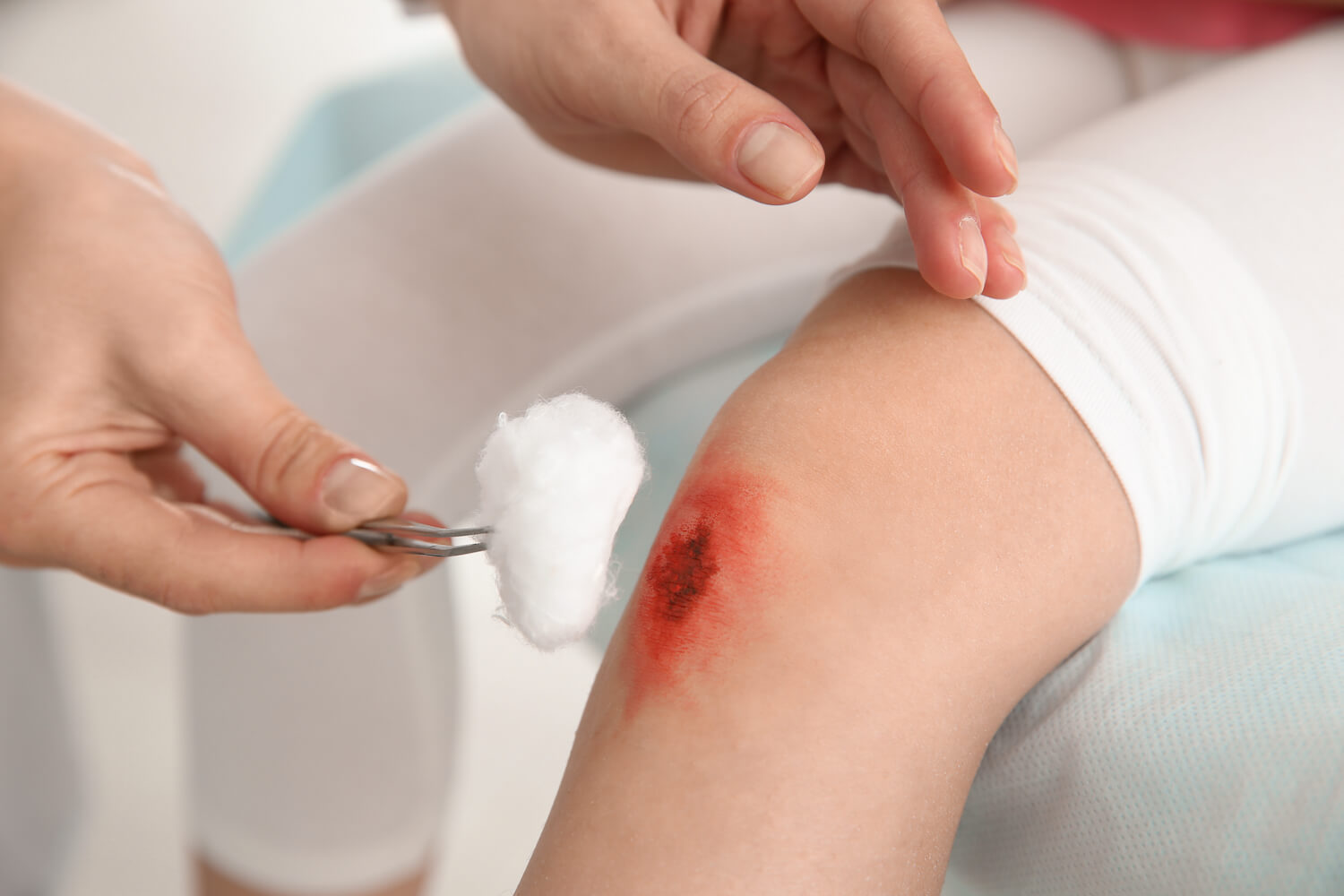 Periwound Management
