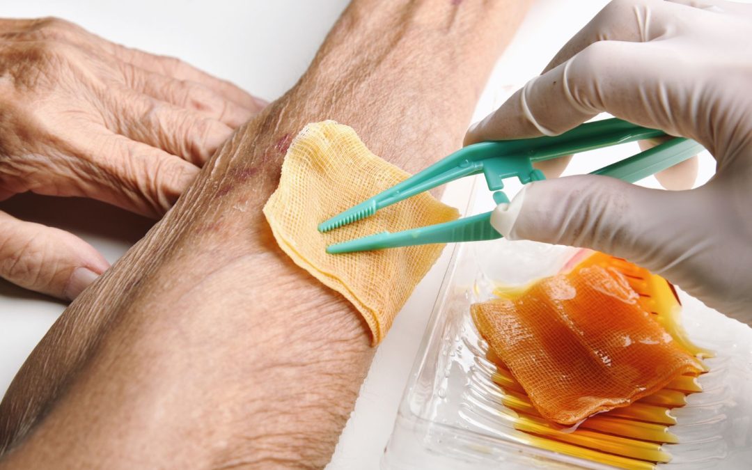 Different Types of Wound Dressings
