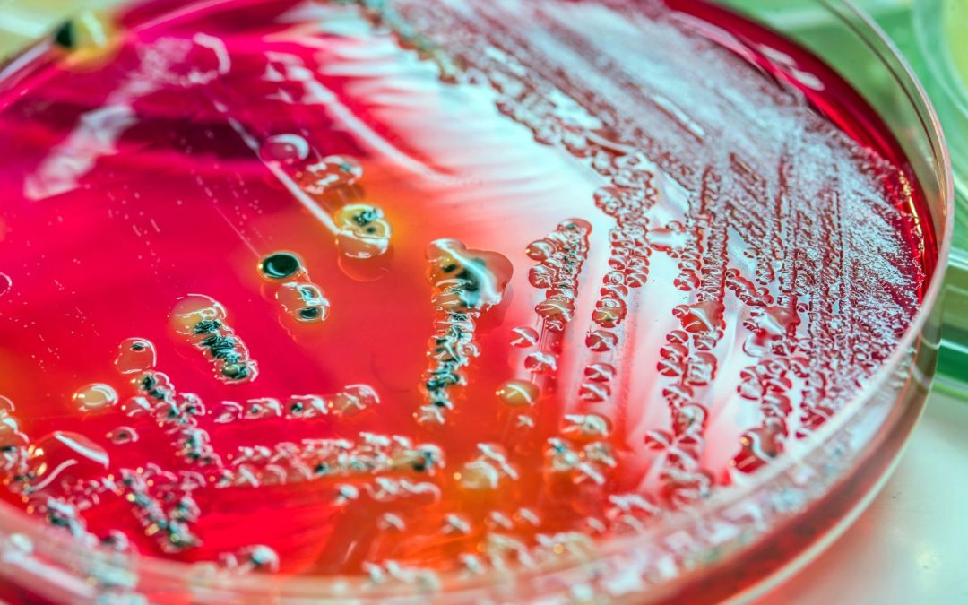 Pseudomonas Skin Infection Causes, Symptoms, Treatment, and Prevention
