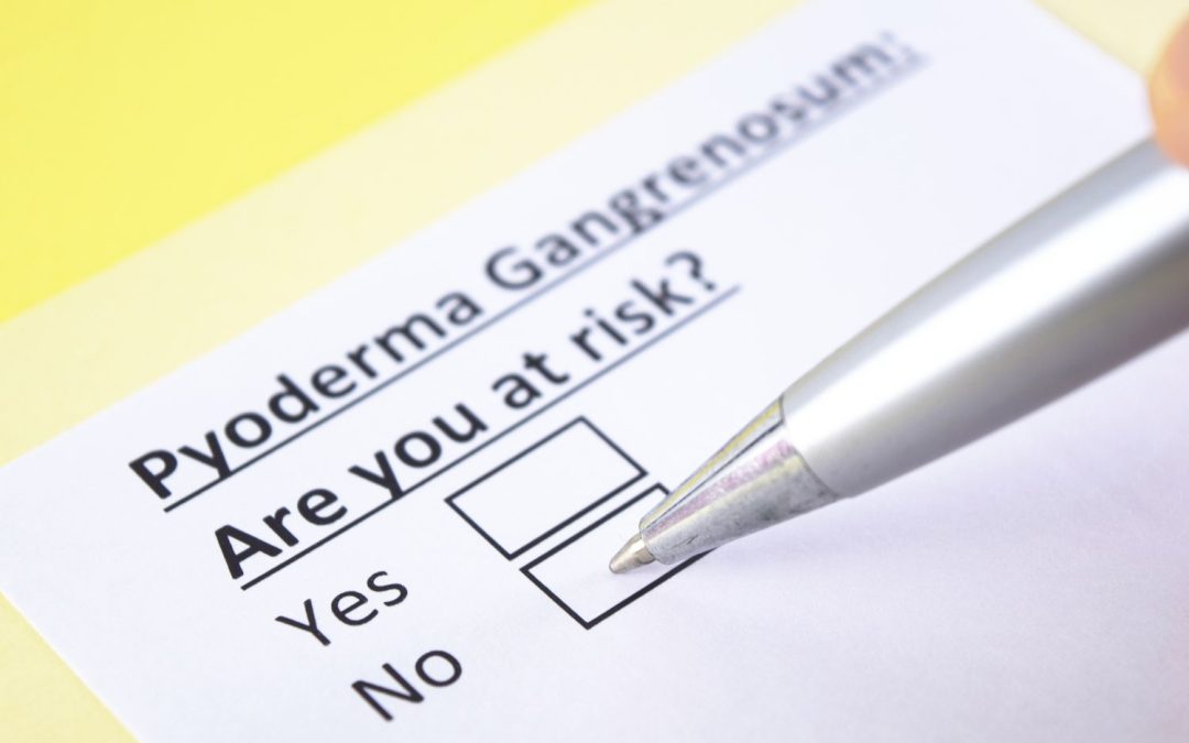 Pyoderma gangrenosum