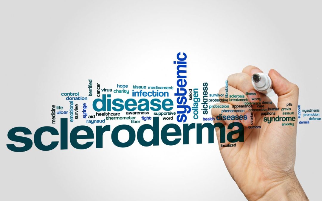 Scleroderma ulcer