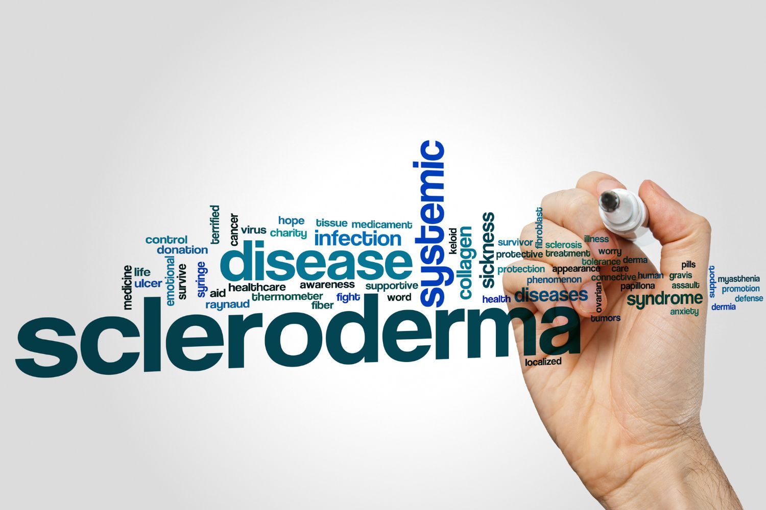 Scleroderma ulcer