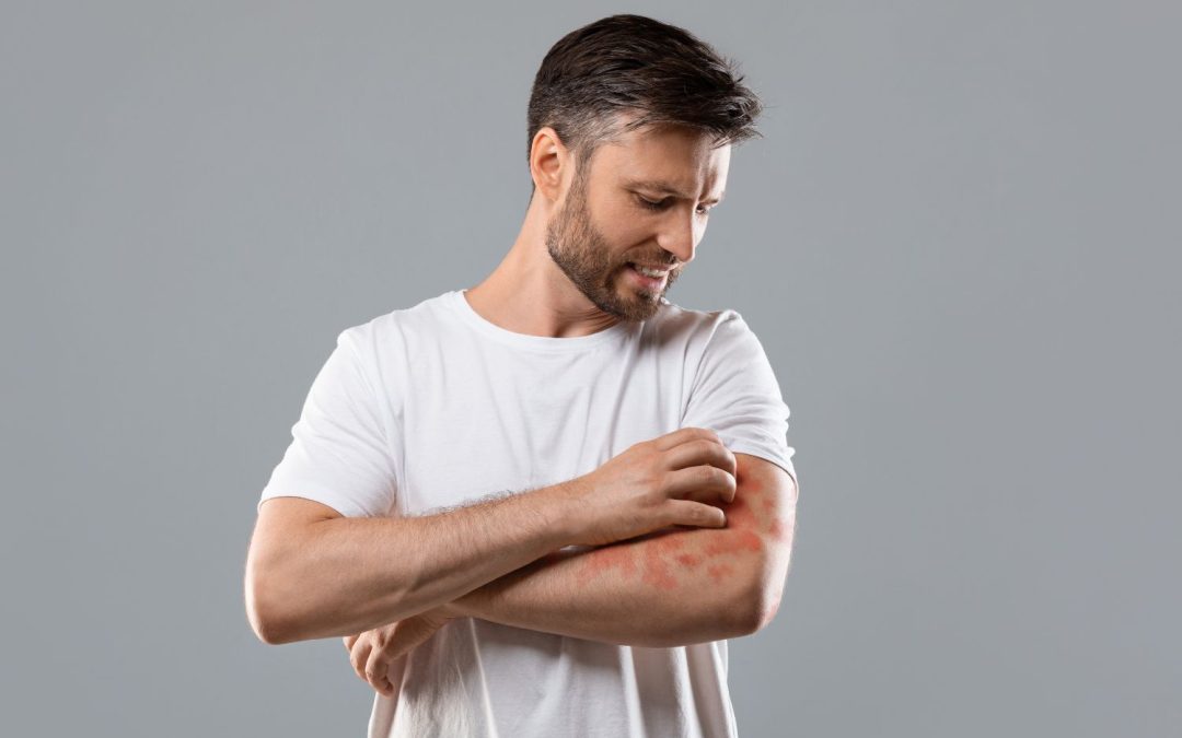 Skin Bacterial Infections Causes, Symptoms, and Treatments
