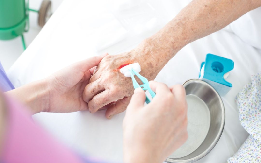 Super-oxidized Disinfectant Solution A Revolutionary Approach for Treating Chronic Wounds