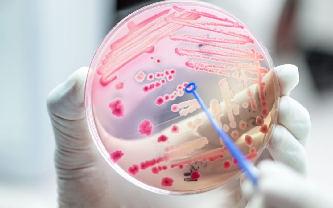 The antimicrobial resistance on wound management